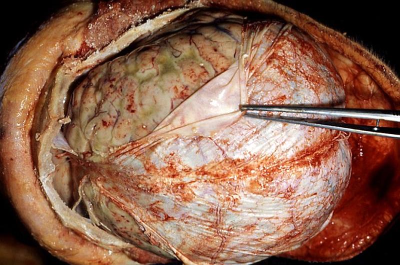 Rozpoznanie i różnicowanie chorób dziecięcych
