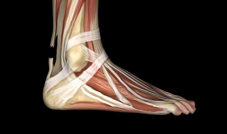 Jak rozpoznać objawy zerwania ścięgna prostownika palca?